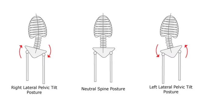 lateral-pelvic-tilt-graphic